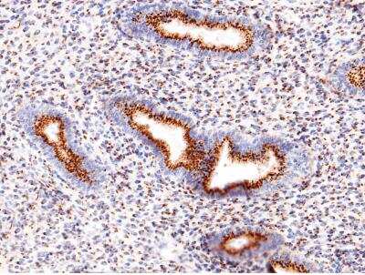 Immunohistochemistry-Paraffin: GOLM1 Antibody (12) [NBP3-12533]
