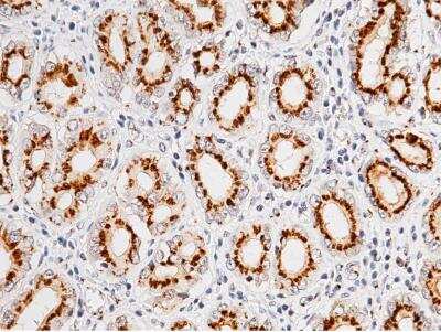 Immunohistochemistry-Paraffin: GOLM1 Antibody (12) [NBP3-12533]