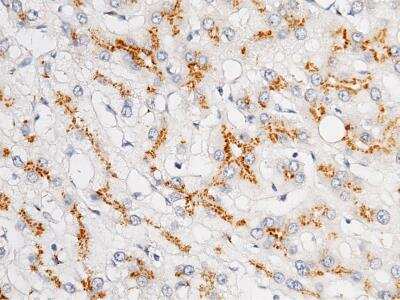 Immunohistochemistry-Paraffin: GOLM1 Antibody (12) [NBP3-12533]