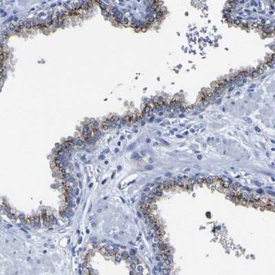 Immunohistochemistry-Paraffin: GOLM1 Antibody [NBP1-88774]