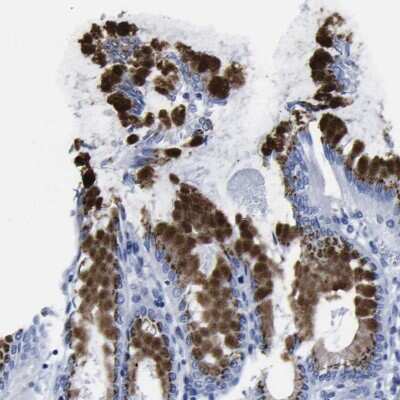 Immunohistochemistry-Paraffin: GOLM1 Antibody [NBP1-88774]
