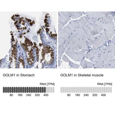 Immunohistochemistry-Paraffin: GOLM1 Antibody [NBP1-88774]