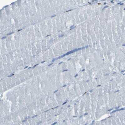 Immunohistochemistry-Paraffin: GOLM1 Antibody [NBP1-88775]