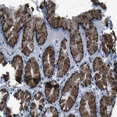Immunohistochemistry-Paraffin: GOLM1 Antibody [NBP1-88775]
