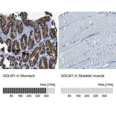 Immunohistochemistry-Paraffin: GOLM1 Antibody [NBP1-88775]