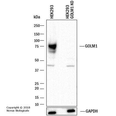 Knockout Validated: GOLM1 Antibody [NBP1-50627]