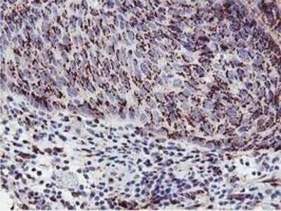 Immunohistochemistry: GOLM1 Antibody (OTI4B12) - Azide and BSA Free [NBP2-71916]
