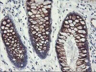Immunohistochemistry: GOLM1 Antibody (OTI4B12) - Azide and BSA Free [NBP2-71916]