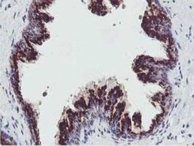 Immunohistochemistry: GOLM1 Antibody (OTI4B12) - Azide and BSA Free [NBP2-71916]