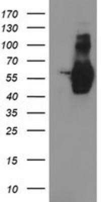 Western Blot: GOLM1 Antibody (OTI4B12)Azide and BSA Free [NBP2-71916]