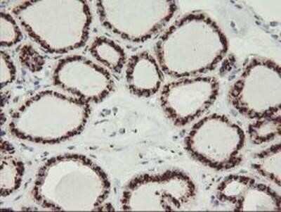 Immunohistochemistry-Paraffin: GOLM1 Antibody (OTI4B12) [NBP2-01639]