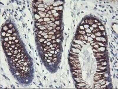 Immunohistochemistry-Paraffin: GOLM1 Antibody (OTI4B12) [NBP2-01639]