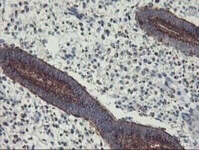 Immunohistochemistry-Paraffin: GOLM1 Antibody (OTI4B12) [NBP2-01639]