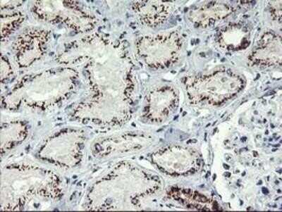 Immunohistochemistry-Paraffin: GOLM1 Antibody (OTI4B12) [NBP2-01639]