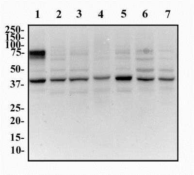 Western Blot: GOLM1 Antibody [NBP1-50627]