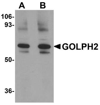 Western Blot: GOLM1 AntibodyBSA Free [NBP1-77079]