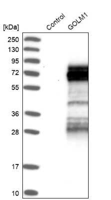 Western Blot: GOLM1 Antibody [NBP1-88774]