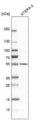 Western Blot: GOLM1 Antibody [NBP1-88775]