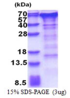 SDS-PAGE: Recombinant Human GOLM1 His Protein [NBP2-23084]