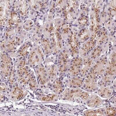 Immunohistochemistry-Paraffin: GOLPH3 Antibody [NBP2-58286]