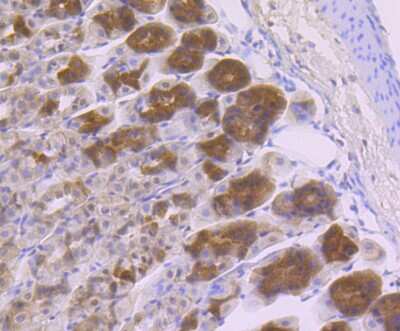 Immunohistochemistry-Paraffin: GOLPH3 Antibody [NBP2-75515]