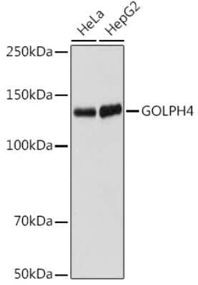 Western Blot: GOLPH4 Antibody (10J7E6) [NBP3-15917]