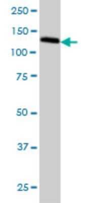 Western Blot: GOLPH4 Antibody (5E11) [H00027333-M01]