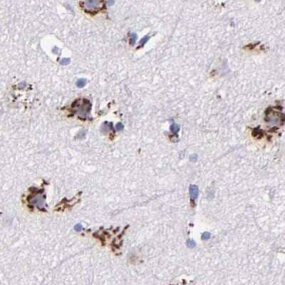 Immunohistochemistry-Paraffin: GOLPH4 Antibody [NBP1-91954]