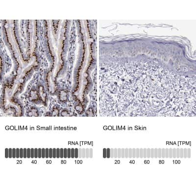 Immunohistochemistry-Paraffin: GOLPH4 Antibody [NBP1-91954]