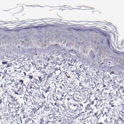 Immunohistochemistry-Paraffin: GOLPH4 Antibody [NBP1-91954]