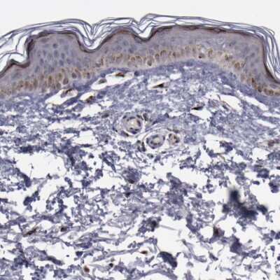 Immunohistochemistry-Paraffin: GOLPH4 Antibody [NBP1-91955]
