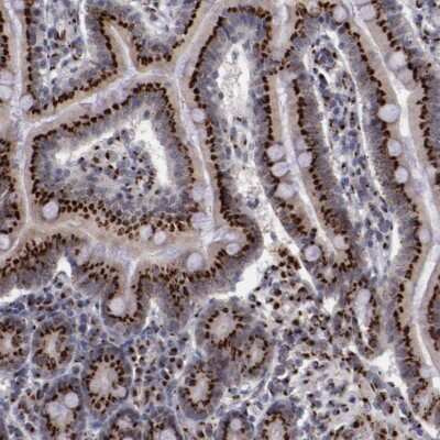 Immunohistochemistry-Paraffin: GOLPH4 Antibody [NBP1-91955]
