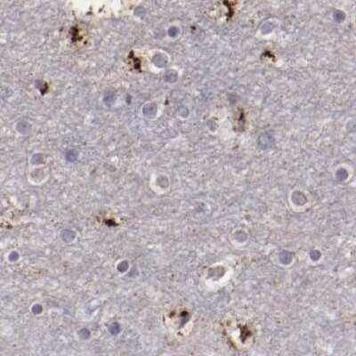 Immunohistochemistry-Paraffin: GOLPH4 Antibody [NBP1-91955]