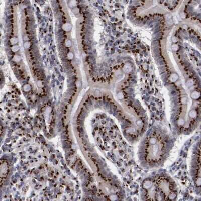 Immunohistochemistry-Paraffin: GOLPH4 Antibody [NBP1-91955]