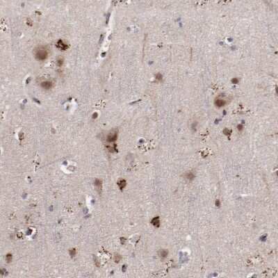Immunohistochemistry-Paraffin: GOLPH4 Antibody [NBP1-91955]