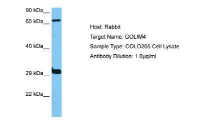 Western Blot: GOLPH4 Antibody [NBP2-87517]