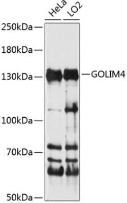 Western Blot: GOLPH4 AntibodyAzide and BSA Free [NBP3-03684]