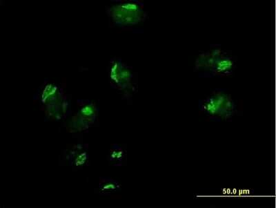 Immunocytochemistry/ Immunofluorescence: GOSR1 Antibody [H00009527-B01P]