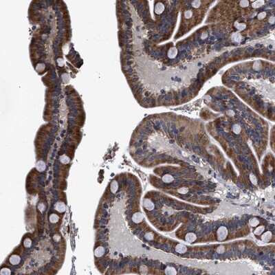 Immunohistochemistry-Paraffin: GOSR1 Antibody [NBP1-83351]