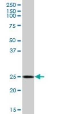 Western Blot: GOSR1 Antibody [H00009527-B01P]