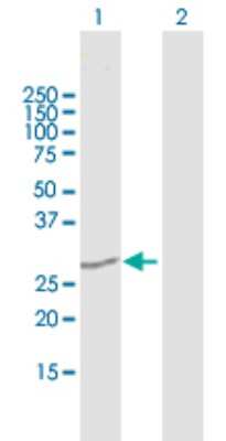 Western Blot: GOSR1 Antibody [H00009527-B01P]