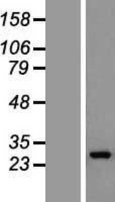 Western Blot: GOSR1 Overexpression Lysate [NBL1-11204]