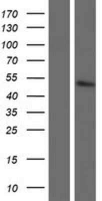 Western Blot: GOT1L1 Overexpression Lysate [NBP2-05384]