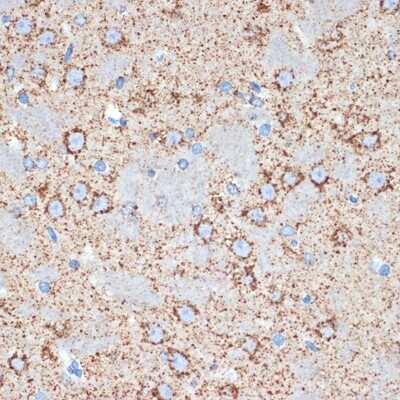 Immunohistochemistry-Paraffin: GOT2 Antibody (4J7O3) [NBP3-15708]