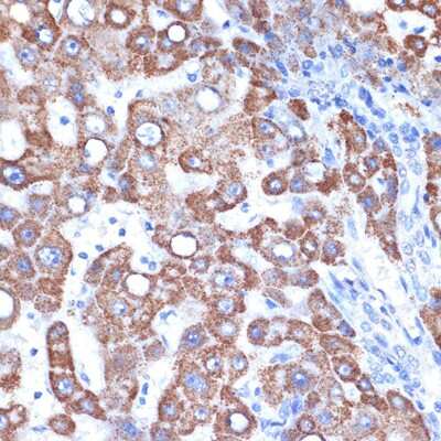 Immunohistochemistry-Paraffin: GOT2 Antibody (4J7O3) [NBP3-15708]