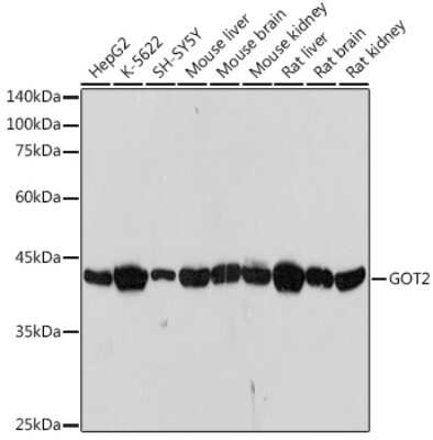 Western Blot: GOT2 Antibody (4J7O3) [NBP3-15708]