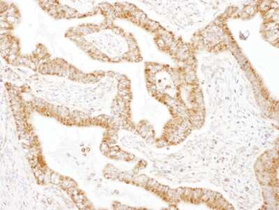 Immunohistochemistry-Paraffin: GOT2 Antibody [NBP2-32241]