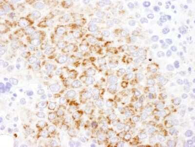 Immunohistochemistry-Paraffin: GOT2 Antibody [NBP2-32241]