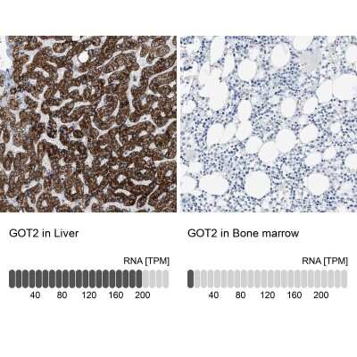 Immunohistochemistry-Paraffin: GOT2 Antibody [NBP1-81565]