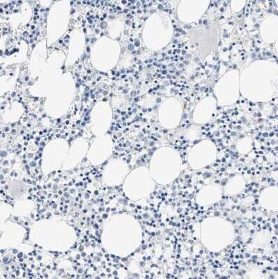 Immunohistochemistry-Paraffin: GOT2 Antibody [NBP1-81565]